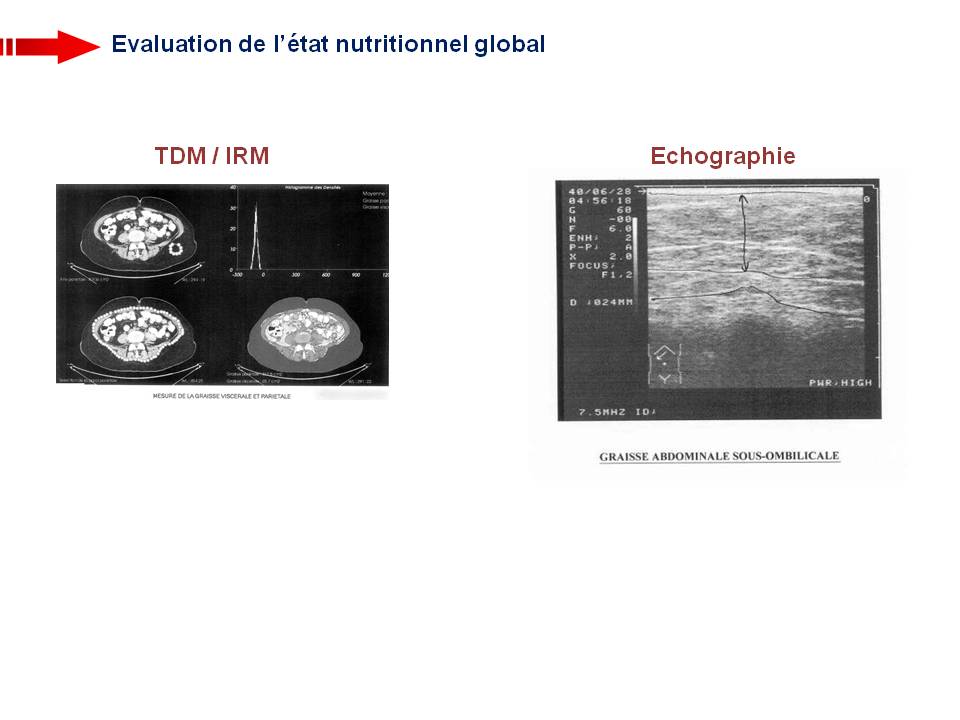 Diapositive14 10