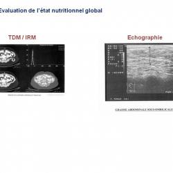 Diapositive14 10