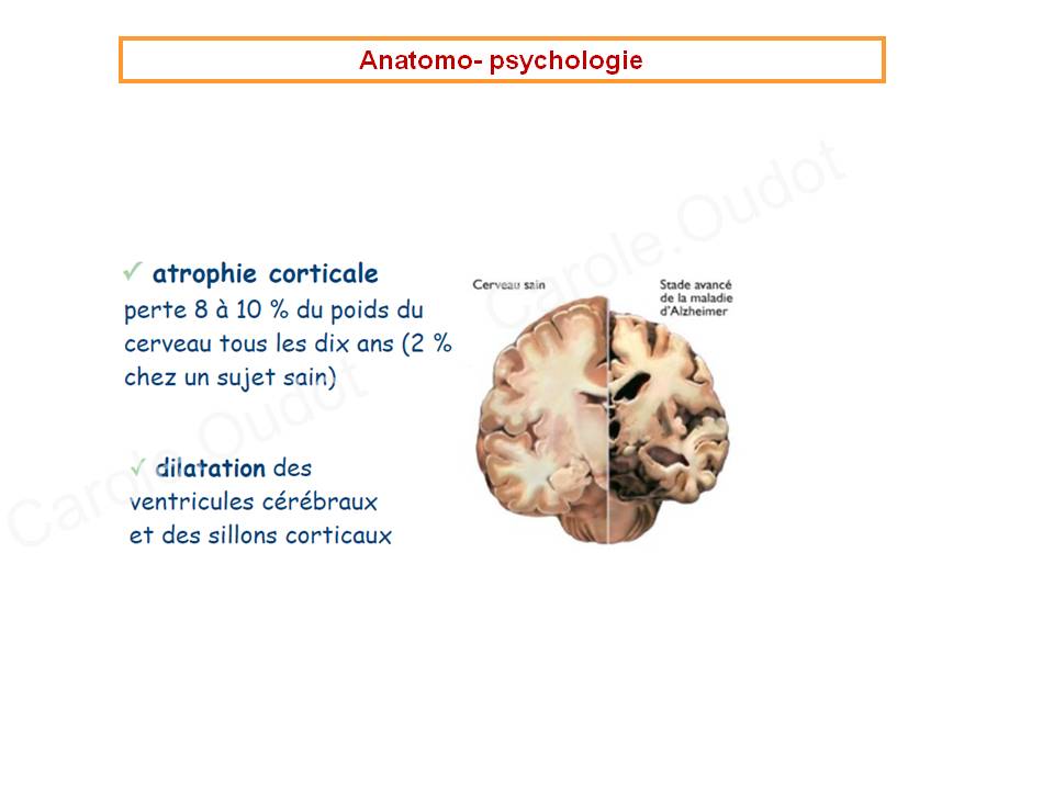 Diapositive19 9