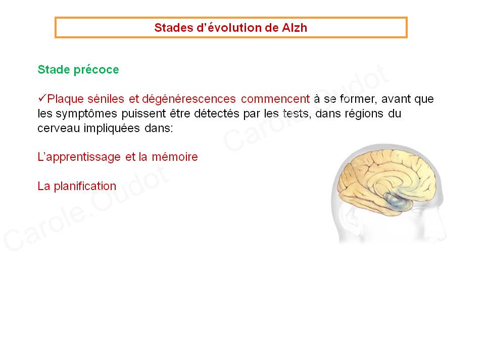 Diapositive26 9
