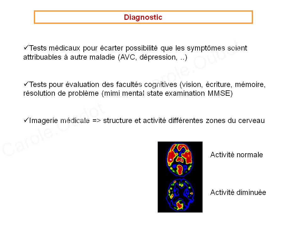 Diapositive33 9
